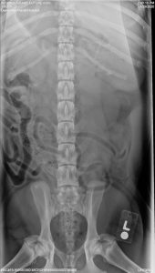 OFA Spine Radiograph - Free of spondylosis or other defects. Normal spine.