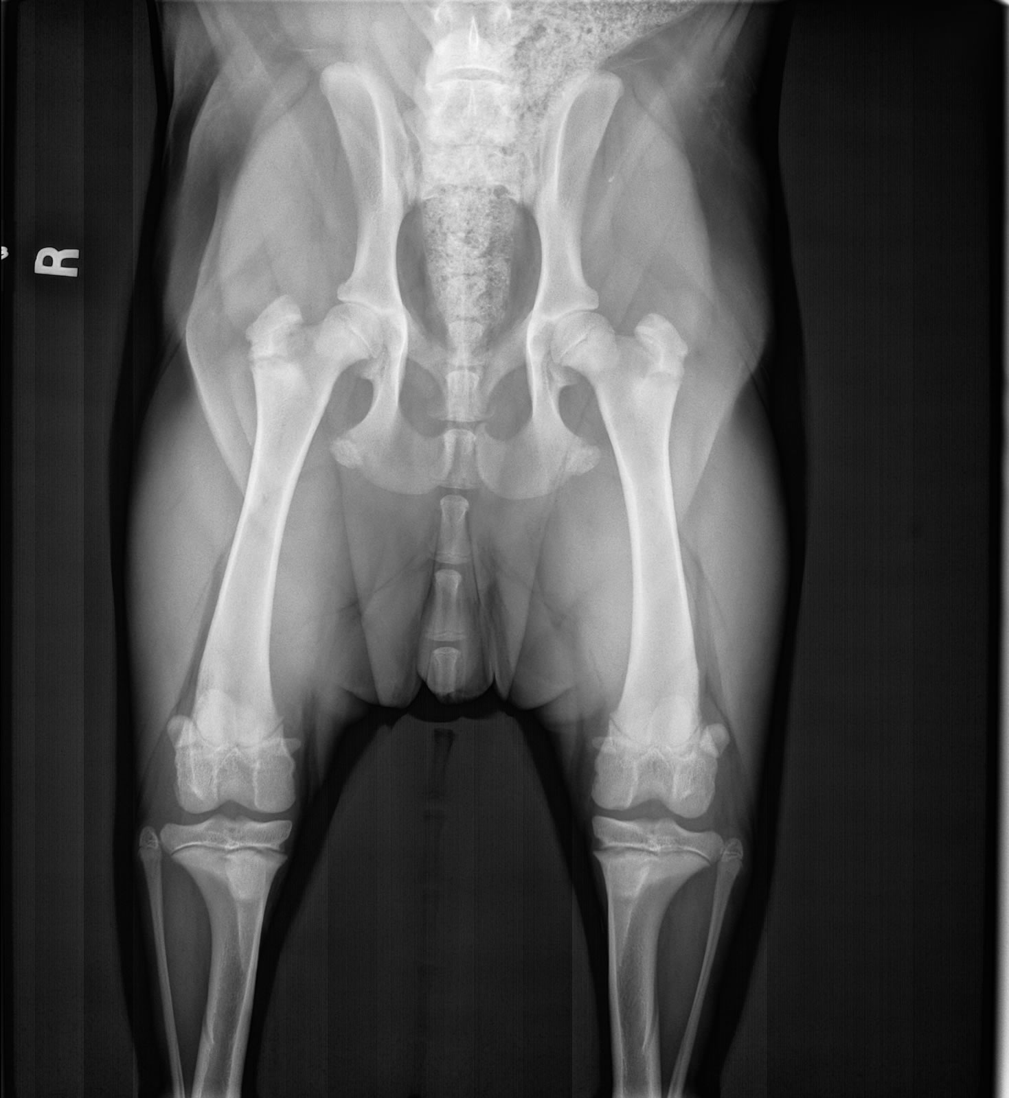 Hip-Extended Radiograph