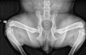 Grand Future Precious - PennHip - Compressed View Radiograph - Normal hips