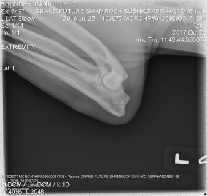 Left Elbow Radiograph