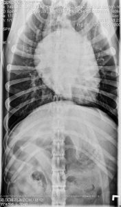 OFA Spine Radiograph