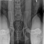 PennHip Radiograph - Distracted View