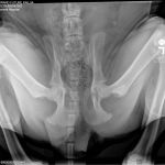 PennHip Radiograph - Compressed View