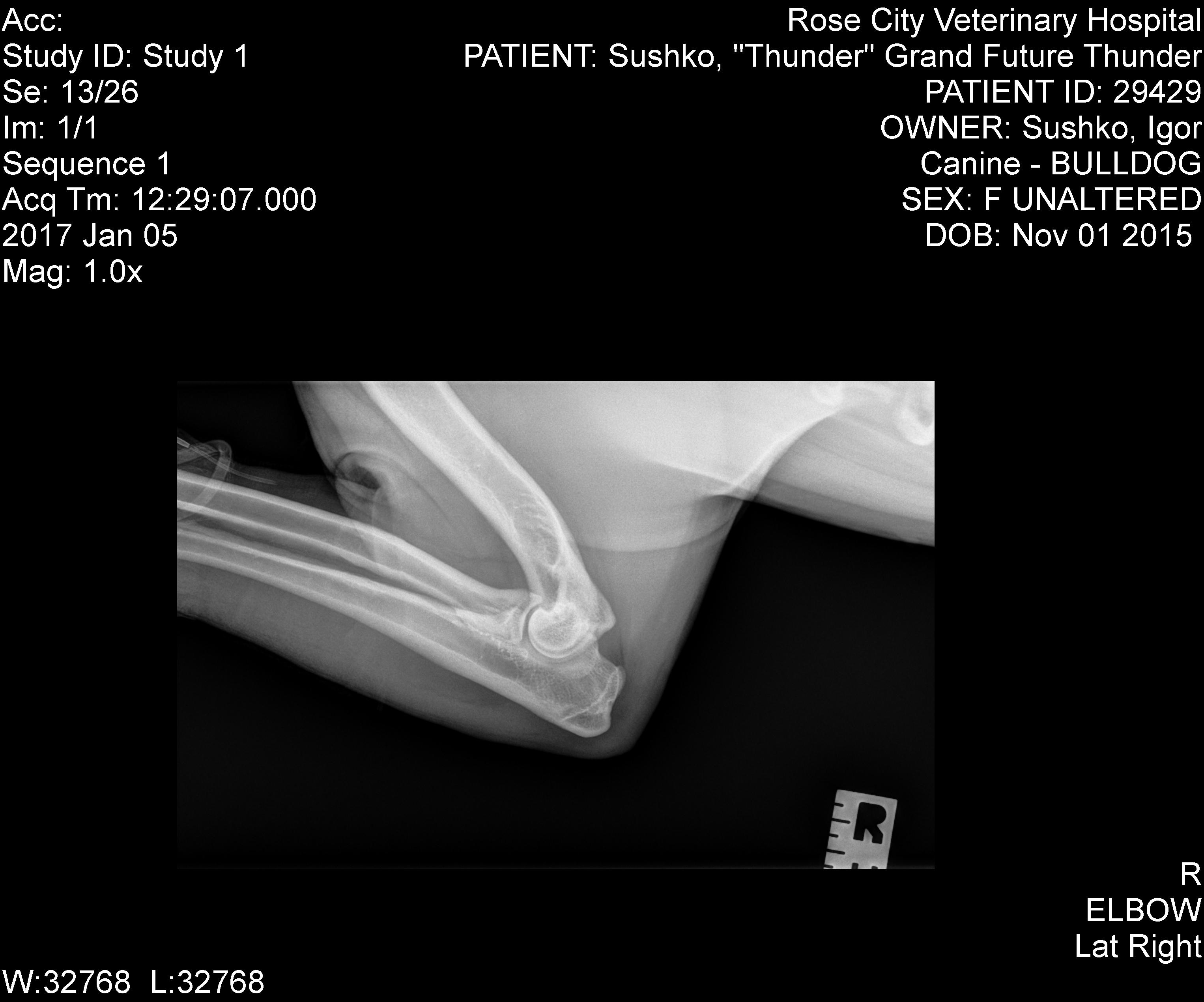 Right Elbow Radiograph